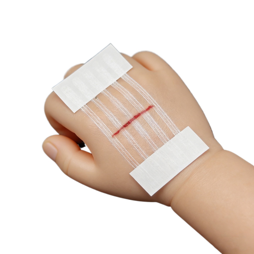 5 Strips Wound Skin Closure St - đánh giá và giá Medical Label