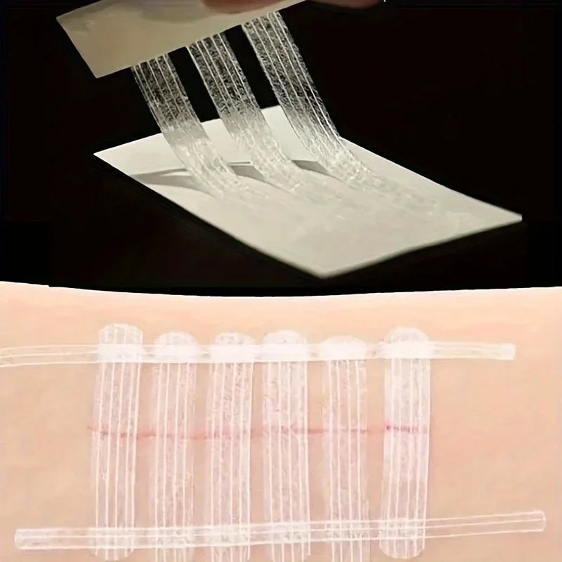 5 Strips Wound Skin Closure St - đánh giá và giá Medical Label