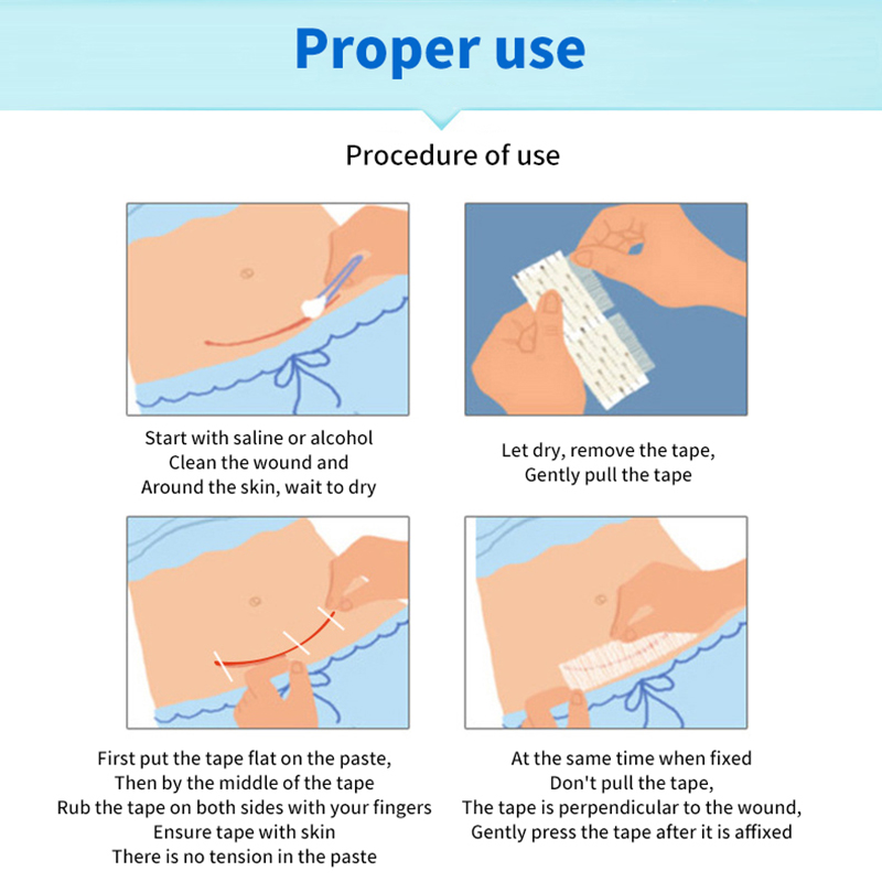 5 Strips Wound Skin Closure St - đánh giá và giá Medical Label